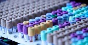How-the-Health-Tech-Industry-Transformed-After-the-Theranos-Scandal
